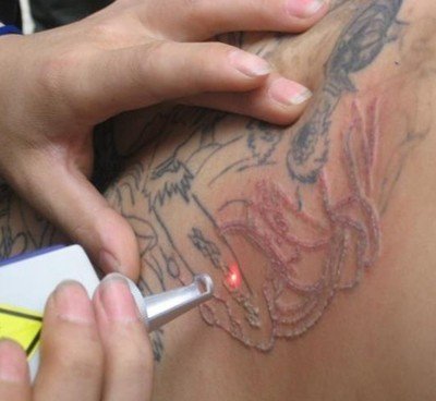 有简单的土办法洗纹身？