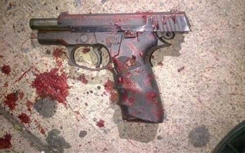 如何治疗枪伤？