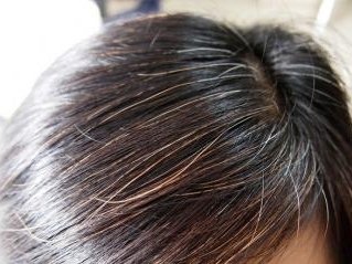 一夜白头真的存在吗，出现的原因是什么？