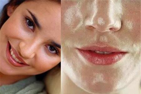 为什么我的脸很油?