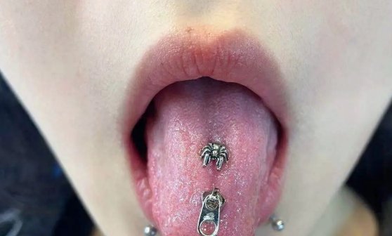 什么是逗龟钉？