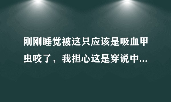 刚刚睡觉被这只应该是吸血甲虫咬了，我担心这是穿说中的螨虫，所以求专家看下这是什么虫，有无危害
