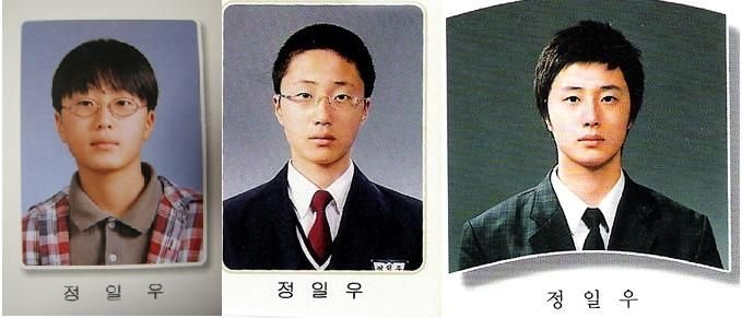 郑日宇整容了吗？