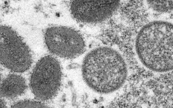 三份猴痘病毒最新基因测序结果公布了，具体的结果是怎样的？