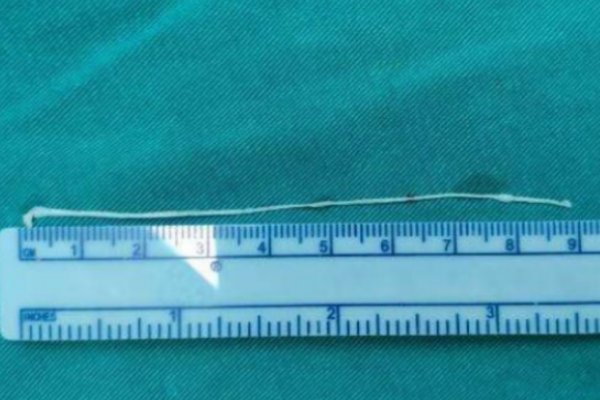 6寸有多少厘米？