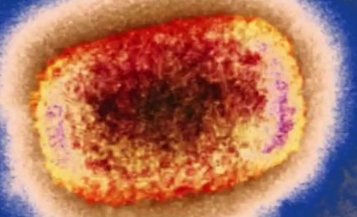 三份猴痘病毒最新基因测序结果公布了，具体的结果是怎样的？