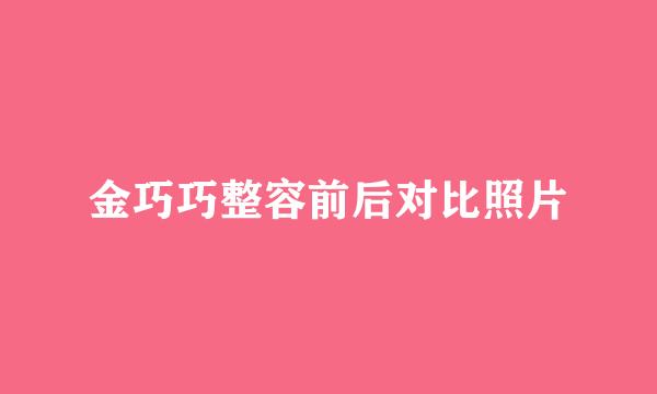 金巧巧整容前后对比照片