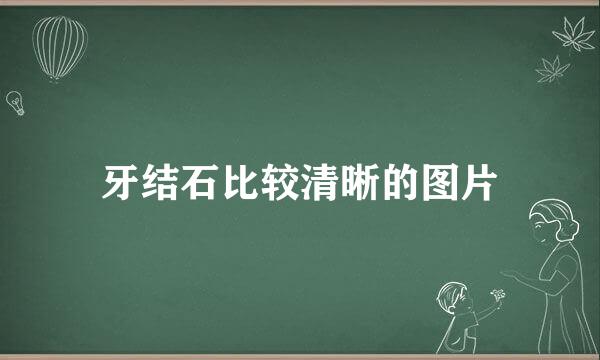 牙结石比较清晰的图片