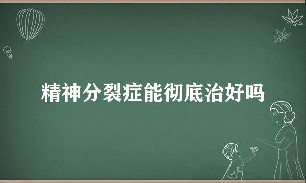 精神分裂症能彻底治好吗