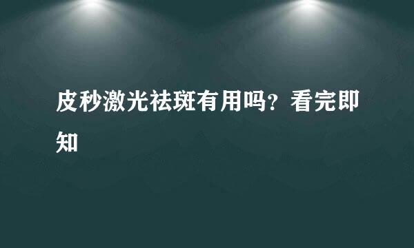 皮秒激光祛斑有用吗？看完即知