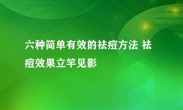 六种简单有效的祛痘方法 祛痘效果立竿见影