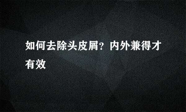 如何去除头皮屑？内外兼得才有效
