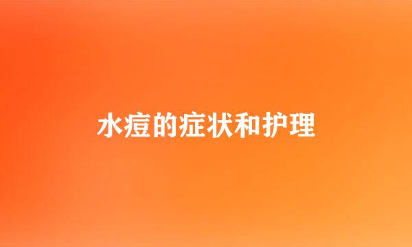 水痘的症状和护理