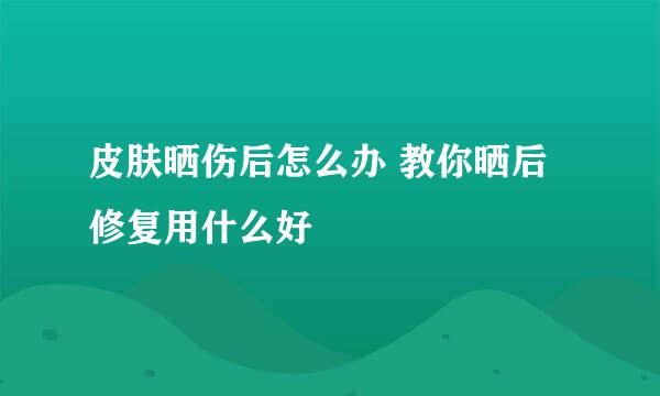 皮肤晒伤后怎么办 教你晒后修复用什么好