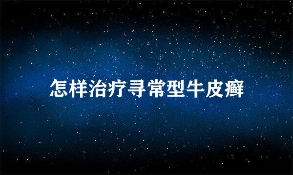 怎样治疗寻常型牛皮癣