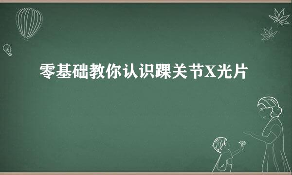 零基础教你认识踝关节X光片