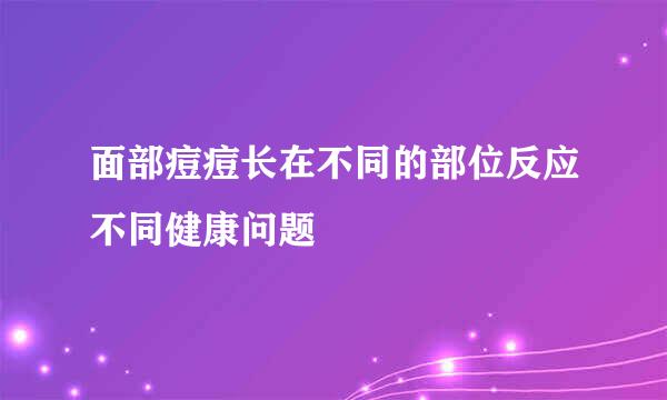 面部痘痘长在不同的部位反应不同健康问题