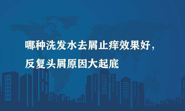 哪种洗发水去屑止痒效果好，反复头屑原因大起底
