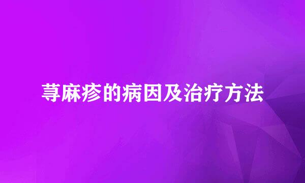 荨麻疹的病因及治疗方法