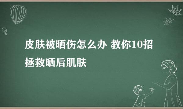 皮肤被晒伤怎么办 教你10招拯救晒后肌肤