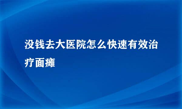 没钱去大医院怎么快速有效治疗面瘫