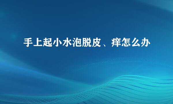 手上起小水泡脱皮、痒怎么办