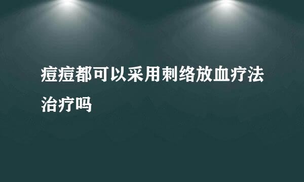 痘痘都可以采用刺络放血疗法治疗吗